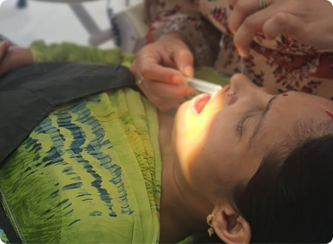 Dental veneers and crowns at Dental Blush, Rohini